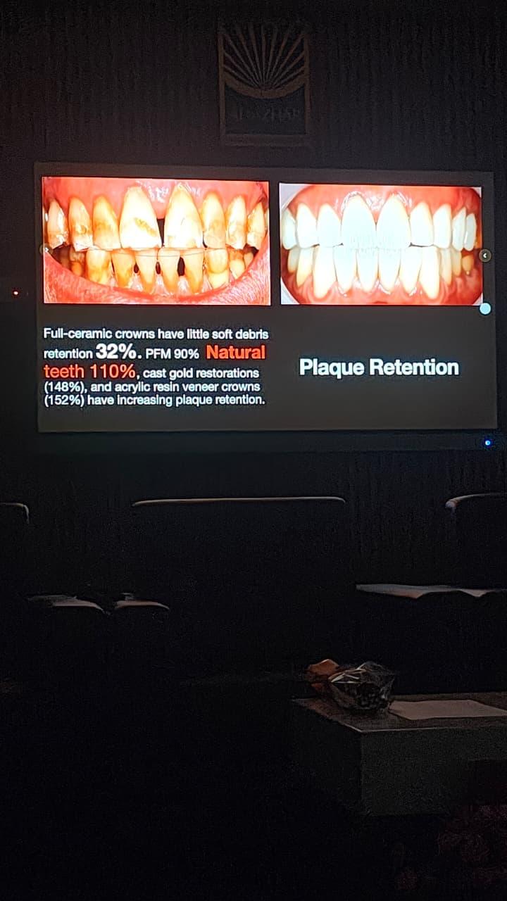 Veneer prep technique- CDE program and hands-on